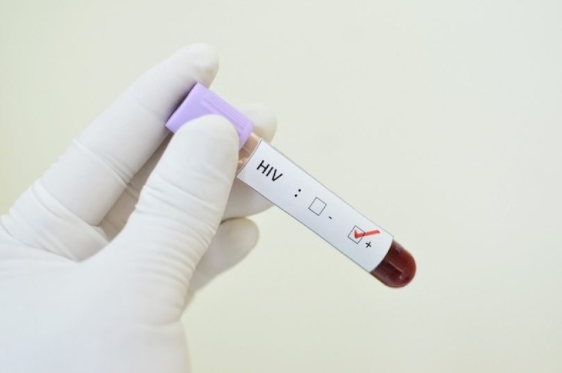 teste-do-hiv_15503_l